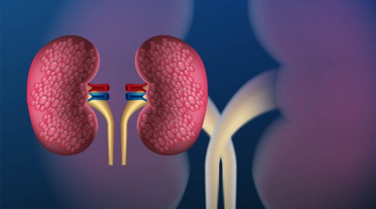 living kidney donor risks