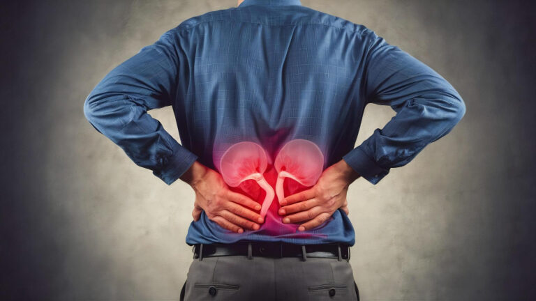 Kidney Stones Obstruction