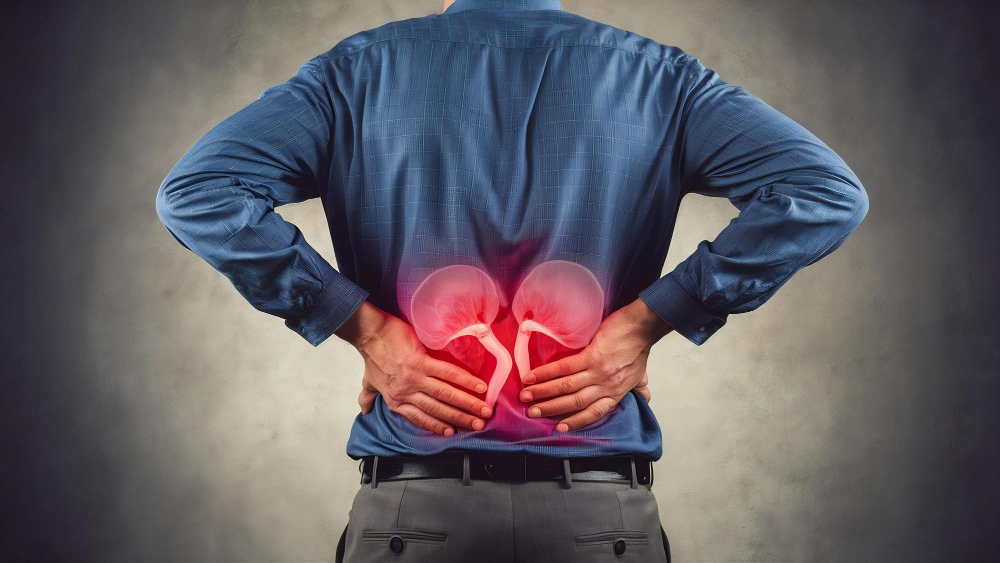 Kidney Stones Obstruction