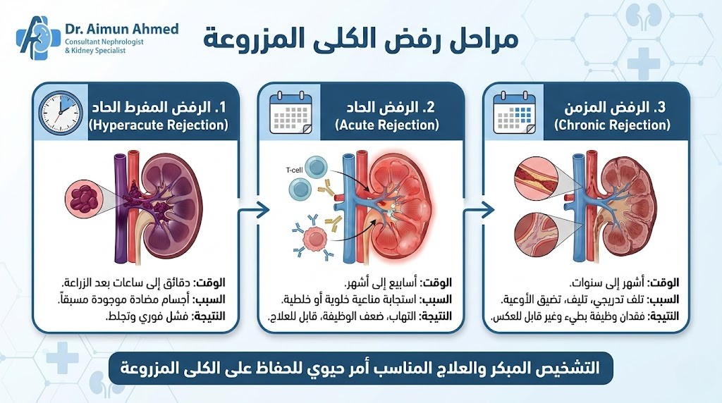 ما هي مراحل رفض الكلى المزروعة؟
